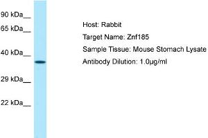 Host: Rabbit Target Name: Znf185 Sample Type: Mouse Stomach lysates Antibody Dilution: 1. (Zinc Finger Protein 185 anticorps  (Middle Region))