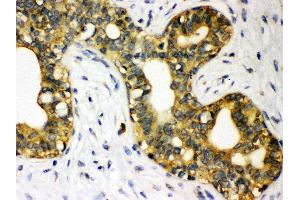Anti- STAT1 Picoband antibody, IHC(P) IHC(P): Human Mammary Cancer Tissue