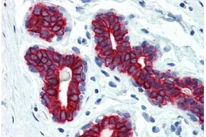 Human Breast (formalin-fixed, paraffin-embedded) stained with Keratin antibody ABIN334246 at 10 ug/ml followed by biotinylated anti-mouse IgG secondary antibody ABIN481714, alkaline phosphatase-streptavidin and chromogen.