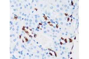 Immunohistochemistry of paraffin-embedded Mouse kidney using ATP6V1G3 Polyclonal Antibody at dilution of 1:100 (40x lens).