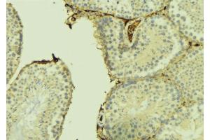 ABIN6275011 at 1/100 staining Mouse testis tissue by IHC-P. (CHPF anticorps  (C-Term))