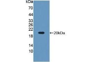 Detection of Recombinant IGFBP3, Mouse using Polyclonal Antibody to Insulin Like Growth Factor Binding Protein 3 (IGFBP3)