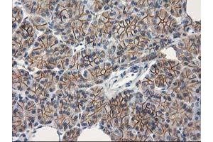 Image no. 7 for anti-Catenin (Cadherin-Associated Protein), beta 1, 88kDa (CTNNB1) antibody (ABIN1496888)