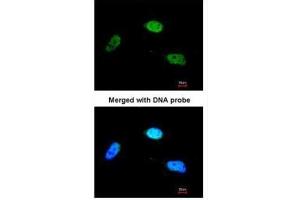 ICC/IF Image Immunofluorescence analysis of paraformaldehyde-fixed HeLa, using ZNF398, antibody at 1:200 dilution.