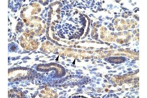 SNAI1 antibody was used for immunohistochemistry at a concentration of 4-8 ug/ml to stain Epithelial cells of renal tubule (arrows) in Human Kidney. (SNAIL anticorps  (N-Term))