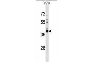 Western blot analysis in Y79 cell line lysates (35ug/lane).
