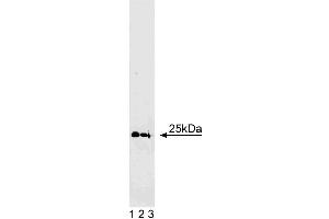 Western blot analysis of Rab5 on human endothelial cell lysate. (RAB5 anticorps  (AA 1-215))