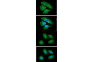 ICC/IF analysis of 14-3-3 epsilon in HeLa cells line, stained with DAPI (Blue) for nucleus staining and monoclonal anti-human 14-3-3 epsilon antibody (1:100) with goat anti-mouse IgG-Alexa fluor 488 conjugate (Green).