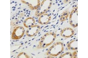 IHC analysis of FFPE human kidney section using PGK1 antibody; Ab was diluted at 1:100.