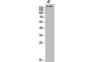 Western Blot analysis of KB cells using COL11A1 Polyclonal Antibody