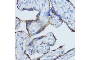 Immunohistochemistry of paraffin-embedded human placenta using Aromatase (CYP19) antibody (2684) at dilution of 1:100 (40x lens).