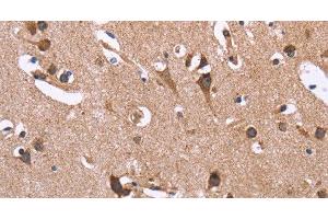 Immunohistochemistry of paraffin-embedded Human brain using SERPINA1 Polyclonal Antibody at dilution of 1:30 (SERPINA1 anticorps)