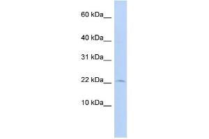 WB Suggested Anti-FKBP2 Antibody Titration: 0. (FKBP2 anticorps  (N-Term))