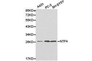 Western Blotting (WB) image for anti-Neurotrophin 4 (NTF4) antibody (ABIN1873969) (Neurotrophin 4 anticorps)