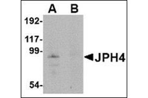 Western blot analysis of JPH4 in mouse brain tissue lysate with this product at 1 μg/ml in (A) the absence and (B) the presence of blocking peptide. (Junctophilin 4 anticorps  (Middle Region))