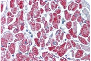 Human Heart: Formalin-Fixed, Paraffin-Embedded (FFPE)