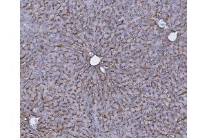 IHC analysis of SLC10A1/NTCP1 using anti-SLC10A1/NTCP1 antibody (ABIN7601234).