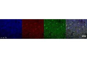 Immunohistochemistry (IHC) image for anti-Glutaminase (GLS) antibody (ABIN7456168)