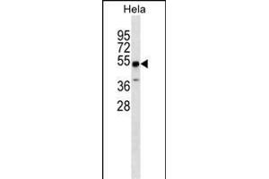 ZSCAN4 Antibody (N-term) (ABIN1539656 and ABIN2849832) western blot analysis in Hela cell line lysates (35 μg/lane). (ZSCAN4 anticorps  (N-Term))
