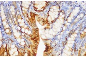Immunohistochemistry of paraffin-embedded Mouse colon using S100A6 Polycloanl Antibody at dilution of 1:150 (S100A6 anticorps)