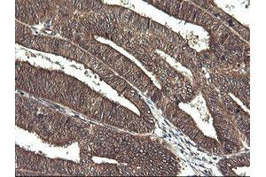 Image no. 4 for anti-Cancer/testis Antigen 1B (CTAG1B) antibody (ABIN1499895) (CTAG1B anticorps)