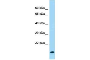 WB Suggested Anti-Gm8008 Antibody Titration: 1. (Gm8008 anticorps  (C-Term))
