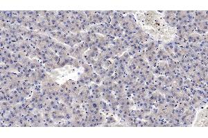 Detection of MASP2 in Human Liver Tissue using Monoclonal Antibody to Mannose Associated Serine Protease 2 (MASP2) (Mannose Associated Serine Protease 2 (AA 170-287) anticorps)