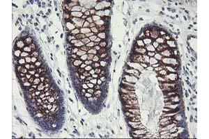 Immunohistochemistry (IHC) image for anti-Golgi Membrane Protein 1 (GOLM1) antibody (ABIN1498491)