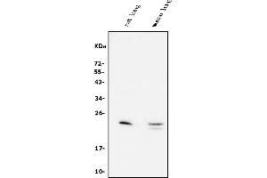 Western blot analysis of Prosurfactant Protein C/SFTPC using anti-Prosurfactant Protein C/SFTPC antibody (ABIN7602713).