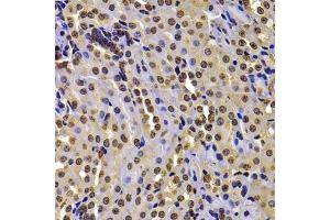Immunohistochemistry of paraffin-embedded mouse kidney using WHSC1 antibody (ABIN6128925, ABIN6150213, ABIN6150214 and ABIN6223939) at dilution of 1:100 (40x lens). (WHSC1 anticorps  (AA 1-240))