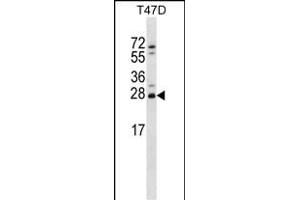 ZT2 Antibody (C-term) (ABIN656733 and ABIN2845957) western blot analysis in T47D cell line lysates (35 μg/lane). (ZMAT2 anticorps  (C-Term))