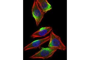 Immunocytochemistry (ICC) image for anti-Calcium/calmodulin-Dependent Protein Kinase IV (CAMK4) (AA 35-292) antibody (ABIN1845379)