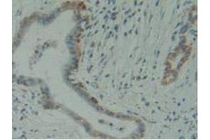 Figure. (HMBS anticorps  (AA 85-337))