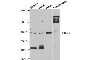 Western blot analysis of extracts of various cell lines, using PRKD3 antibody (ABIN5974259) at 1/1000 dilution. (PRKD3 anticorps)