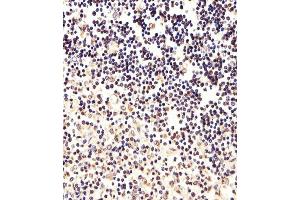 Immunohistochemical analysis of paraffin-embedded H. (FOXP1 anticorps  (C-Term))