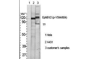 Western Blot (WB) analysis of specific cells using Phospho-EphB1/2 (Y594/604) Polyclonal Antibody. (EPHB1/2 anticorps  (pTyr594, pTyr604))