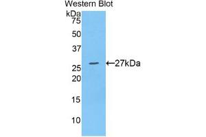 Western blot analysis of the recombinant protein. (ADAM10 anticorps  (AA 218-445))