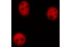 ABIN6269156 staining A549 cells by ICC/IF. (RPA2 anticorps  (N-Term))