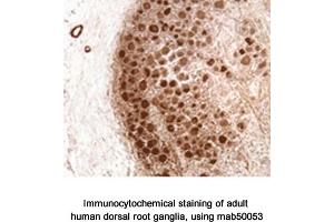 Image no. 2 for anti-Neurofibromin 1 (NF1) (N-Term) antibody (ABIN363207)