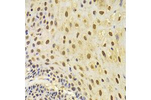 Immunohistochemistry (IHC) image for anti-Keratin 8 (KRT8) (AA 1-483) antibody (ABIN3021288)