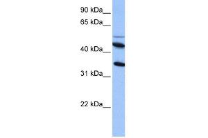 WB Suggested Anti-IL13RA2 Antibody Titration: 0. (IL13RA2 anticorps  (Middle Region))