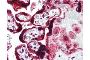 Anti-FERMT1 antibody IHC of human placenta.