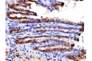 IHC analysis of AGPAT2 using anti-AGPAT2 antibody (ABIN7602435).