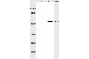 Lane 1: rat brain lysates Lane 2: rat heart lysates probed with Anti ABI1 Polyclonal Antibody, Unconjugated (ABIN675953) at 1:200 in 4 °C. (ABI1 anticorps  (AA 101-200))