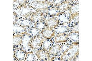 anti-Laminin, gamma 1 (LAMC1) (all Isoforms) antibody