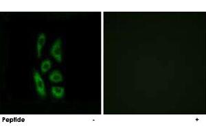 Immunofluorescence analysis of A-549 cells, using ACOT12 polyclonal antibody . (ACOT12 anticorps)