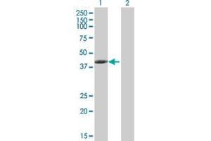 Western Blot analysis of TMOD3 expression in transfected 293T cell line by TMOD3 MaxPab polyclonal antibody. (TMOD3 anticorps  (AA 1-352))