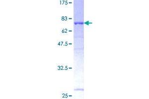 Image no. 1 for UBA Domain Containing 1 (UBAC1) (AA 1-405) protein (GST tag) (ABIN1324310)