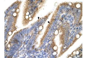 TRPM5 antibody was used for immunohistochemistry at a concentration of 4-8 ug/ml to stain Epithelial cells of intestinal villus (arrows) in Human Intestine. (TRPM5 anticorps  (N-Term))