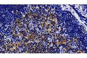 Detection of TLR5 in Rat Thymus Tissue using Polyclonal Antibody to Toll Like Receptor 5 (TLR5)
